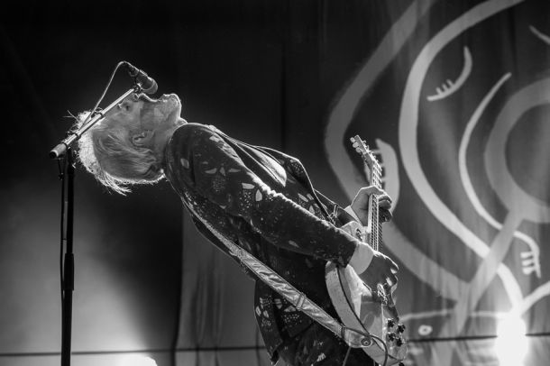 Triggerfinger